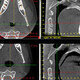 The Dental Professional’s Role in the Evaluation, Diagnosis & Treatment of Snoring and Sleep Apnea