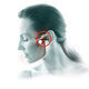 Temporomandibular Disorders: A Multidisciplinary Approach