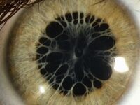 Clinical Conference: Cataract/Comprehensive
