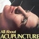 An American History of Chinese Acupuncture: Tamara Venit-Shelton