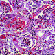 Science of Sci-Fi—Zombie Pathology: A survival guide for pandemics in the 21st century