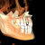 Diagnosis and Treatment of Dental Cases: A Multidisciplinary Approach