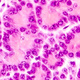 Nutrient Signals and Regulation of Islet Function